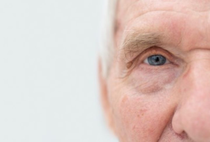 Cataracts 1